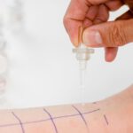 Spezifische Immuntherapie beim Kinderarzt