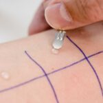 Spezifische Immuntherapie beim Kinderarzt