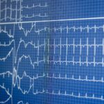 EKG beim Kinderarzt für Kinder